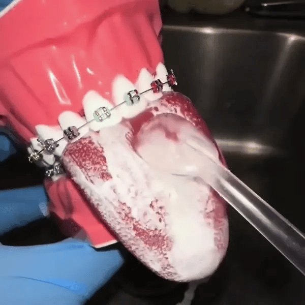 Aquapulse Waterflosser